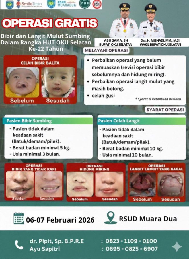 
					Wujud Kepedulian Sosial, Pemkab OKU Selatan Gelar Operasi Gratis Bibir dan Langit-Langit Sumbing